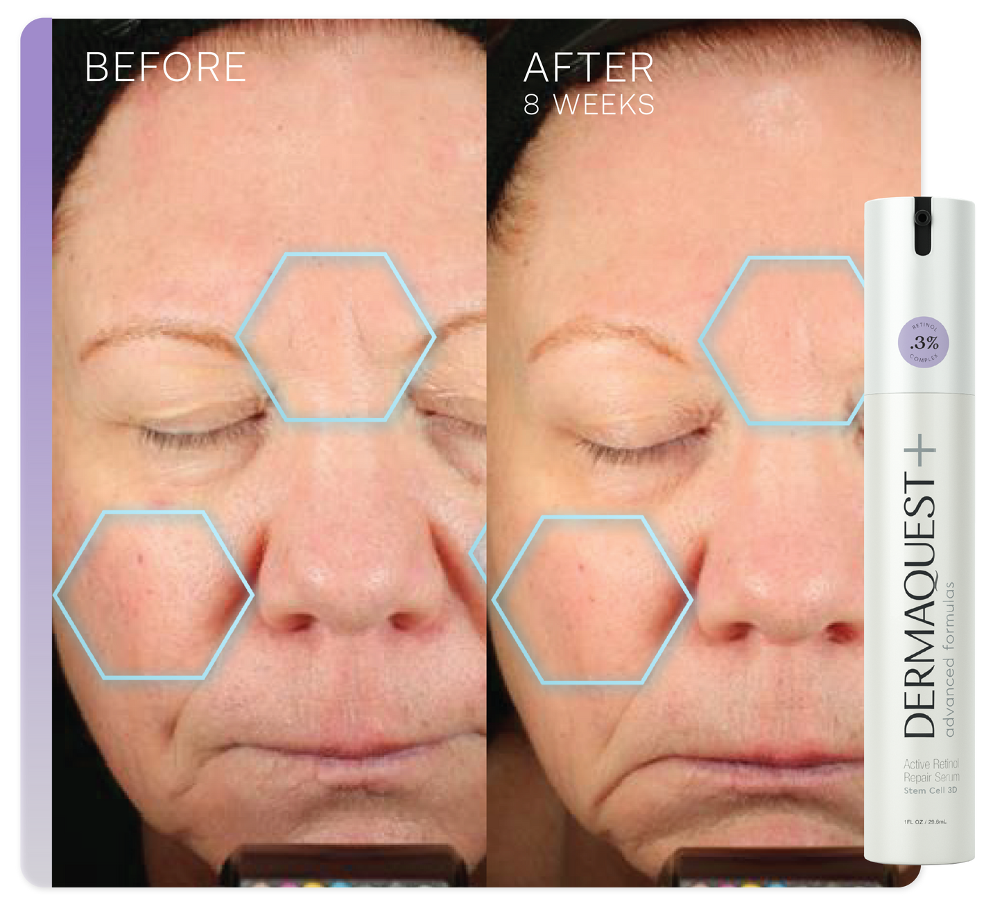 Active Retinol Repair Serum 0.3%