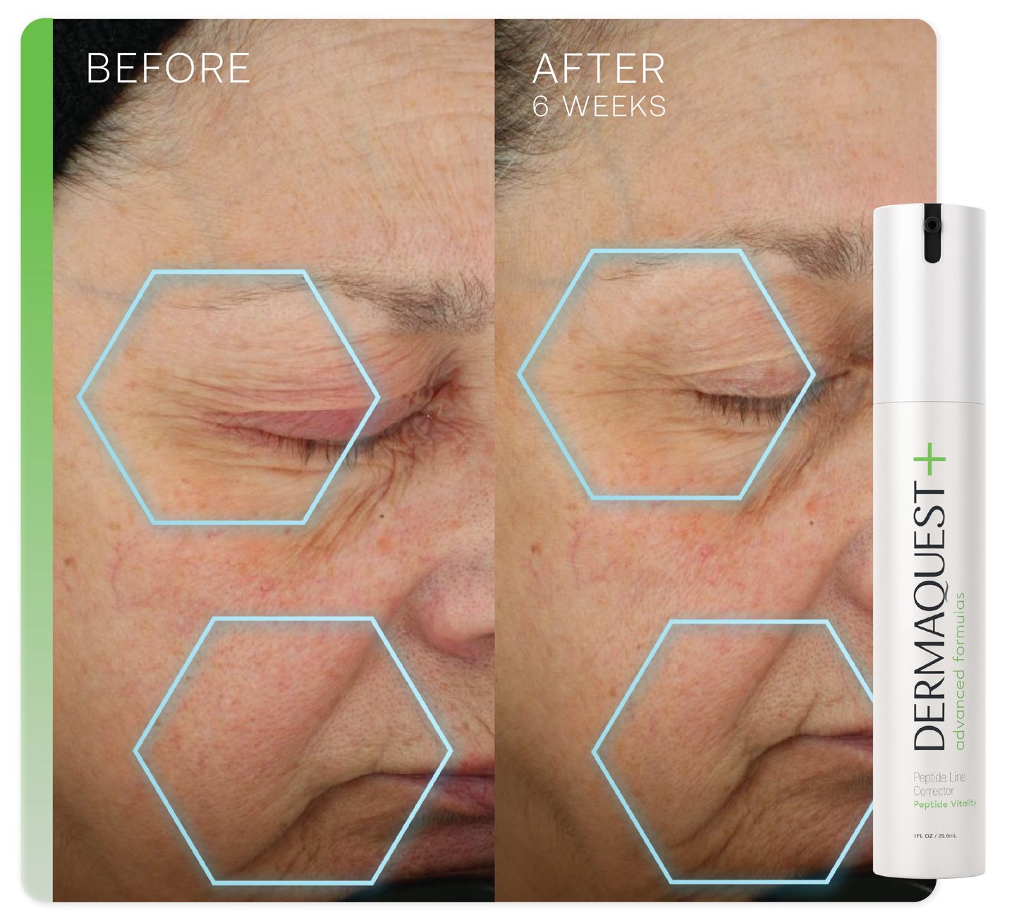 Advanced Peptide Line Corrector