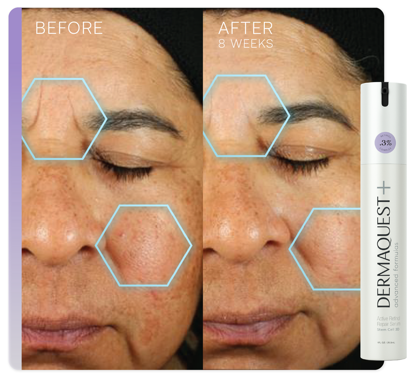 Active Retinol Repair Serum 0.3%