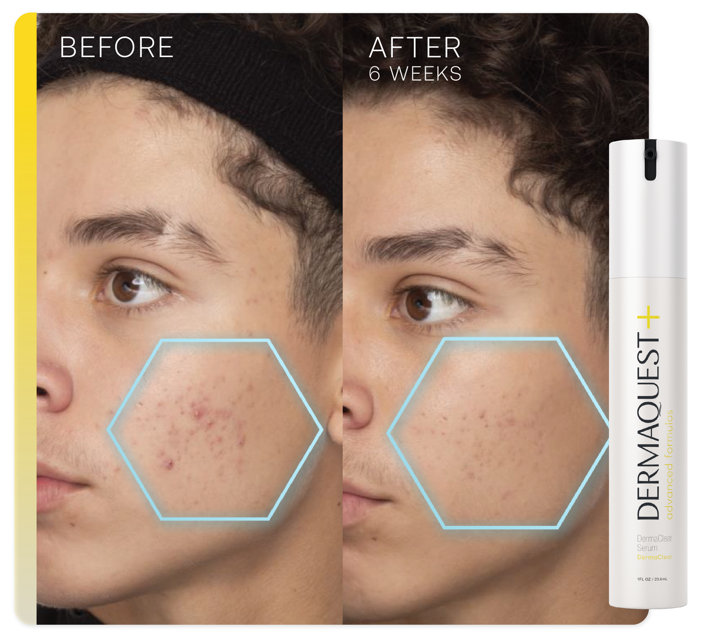Advanced DermaClear Serum