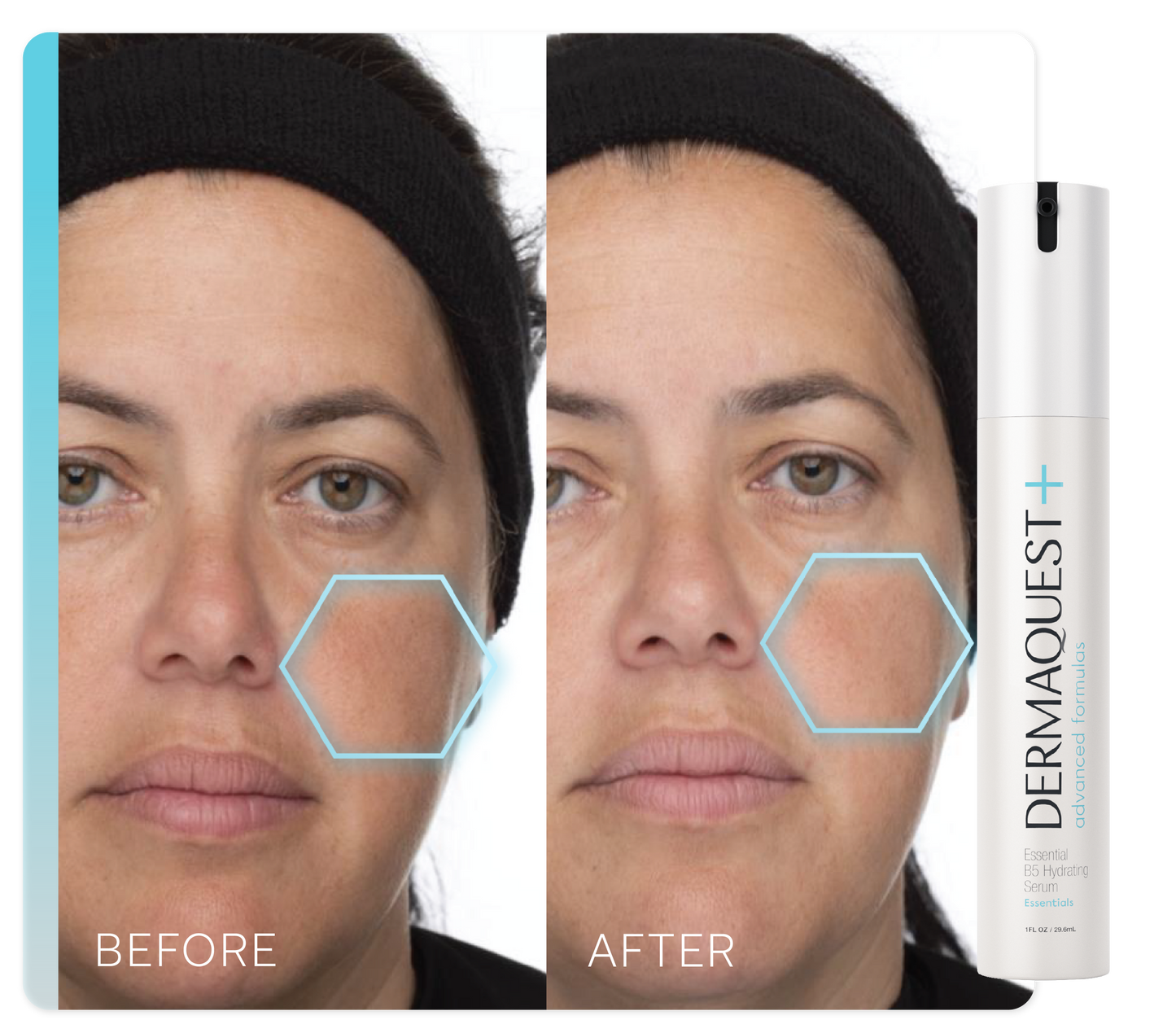 Advanced Essential B5 Hydrating Serum